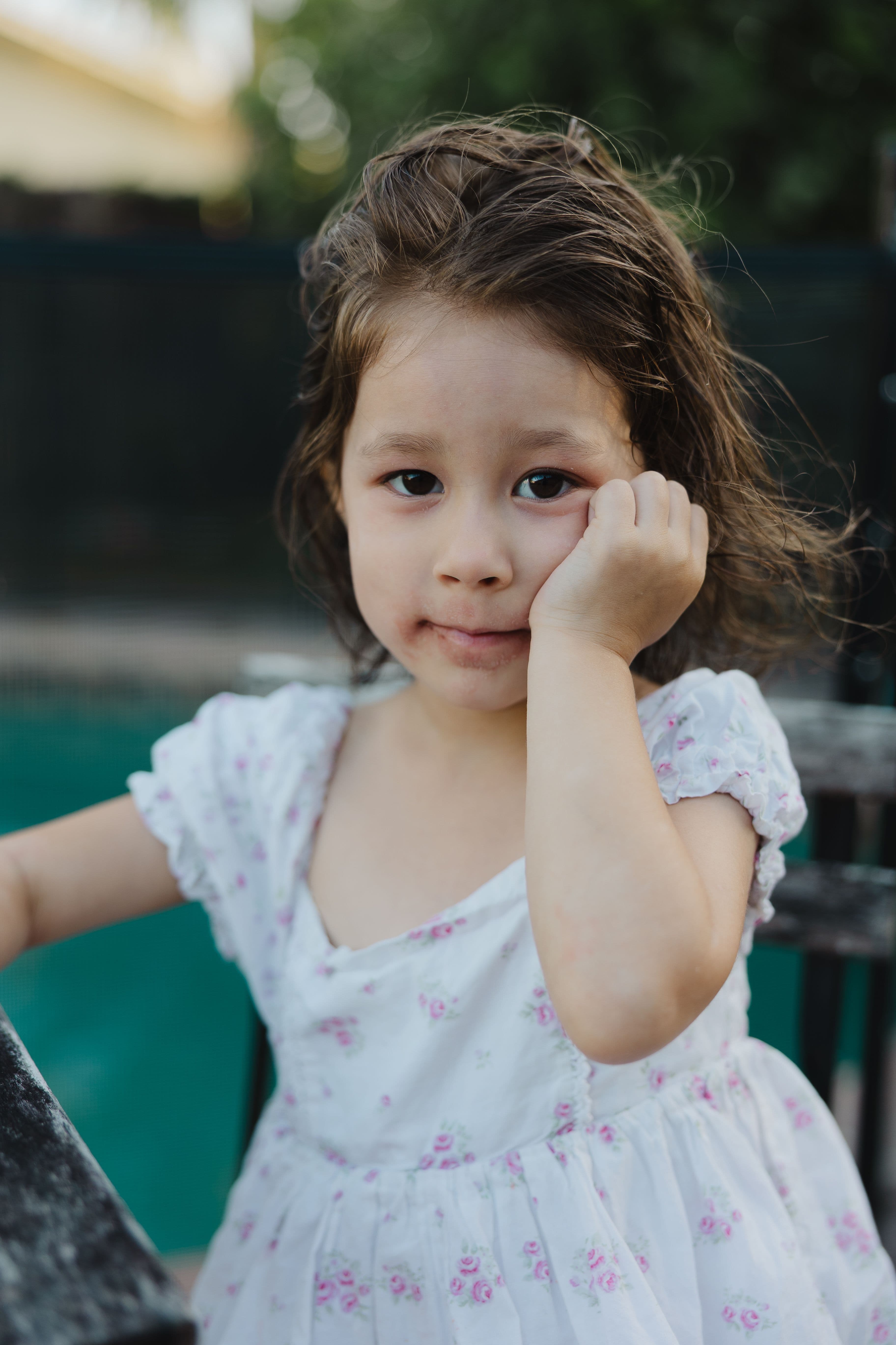 Young girl with eczema resting her cheek on her hand by the pool, candid Fort Lauderdale family session.